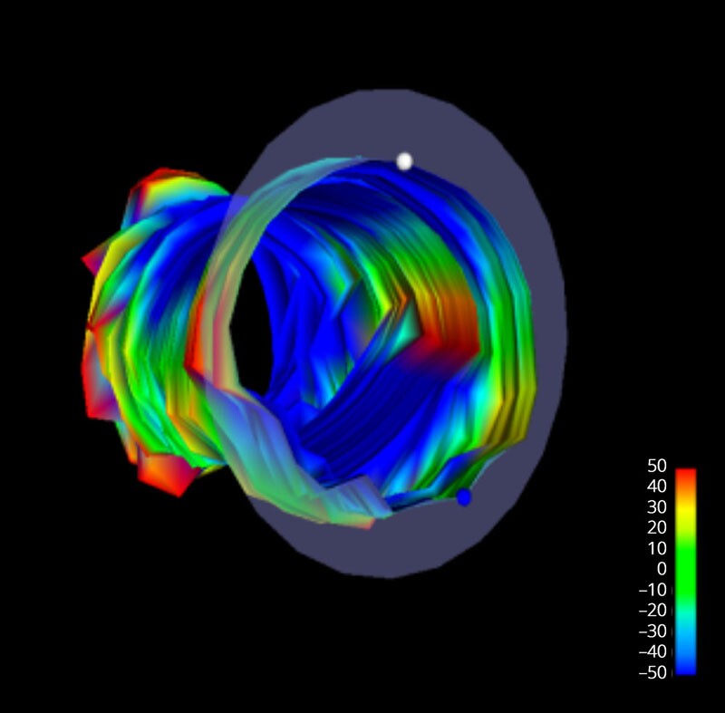 Fig. 5—Multi-arm-caliper logging tool monitoring result. Source: Vertechs Group.