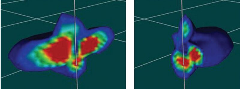 jpt-2018-03-fracturingside-zones.jpg