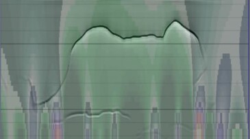 gravity field overlaid on seismic