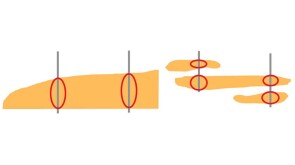 A simplified schematic showing what the common deepwater vertical frac and packdevelopment strategy would look like in both a) a thicker, continuous sand (left) or b) stacked sands (right).