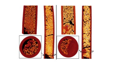 Fig. 1—CT scans for Experiments 2 (left) and 3 (right).